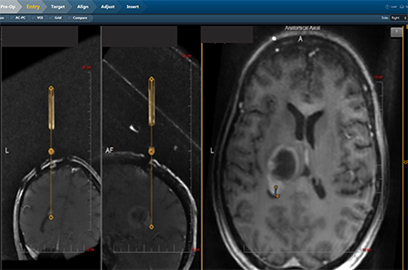 Real-Time Visualization