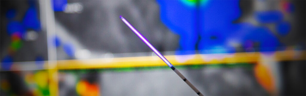Clearpoint Device ClearPoint Prism System Questions - ClearPoint Neuro